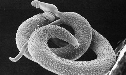 Schistosoma mansoni